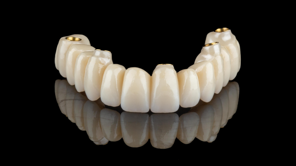 Dentes Fixos num só dia